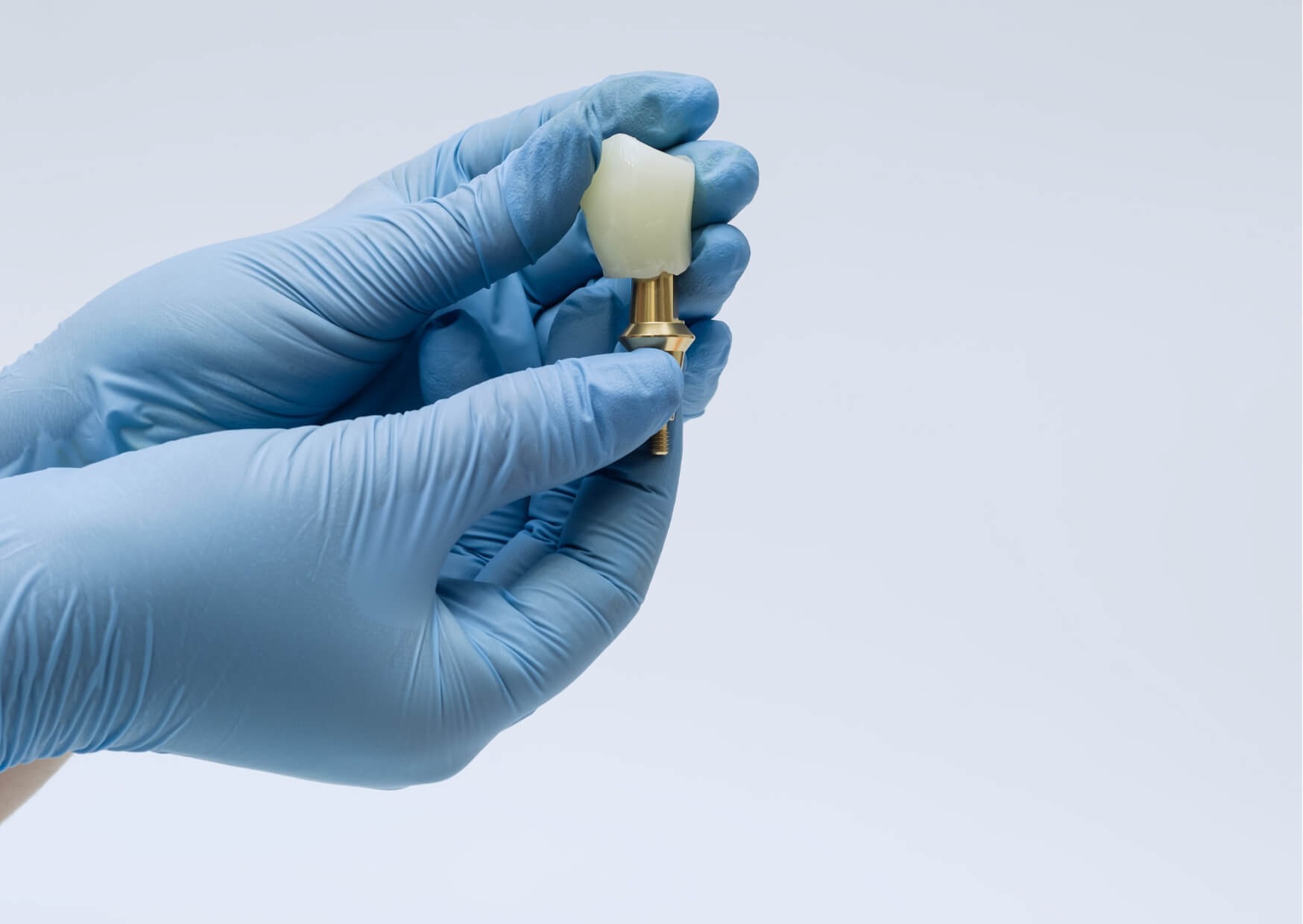 Close-up of a dental implant crown held by a dentist, representing factors that affect dental implant costs